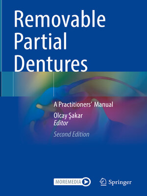 cover image of Removable Partial Dentures